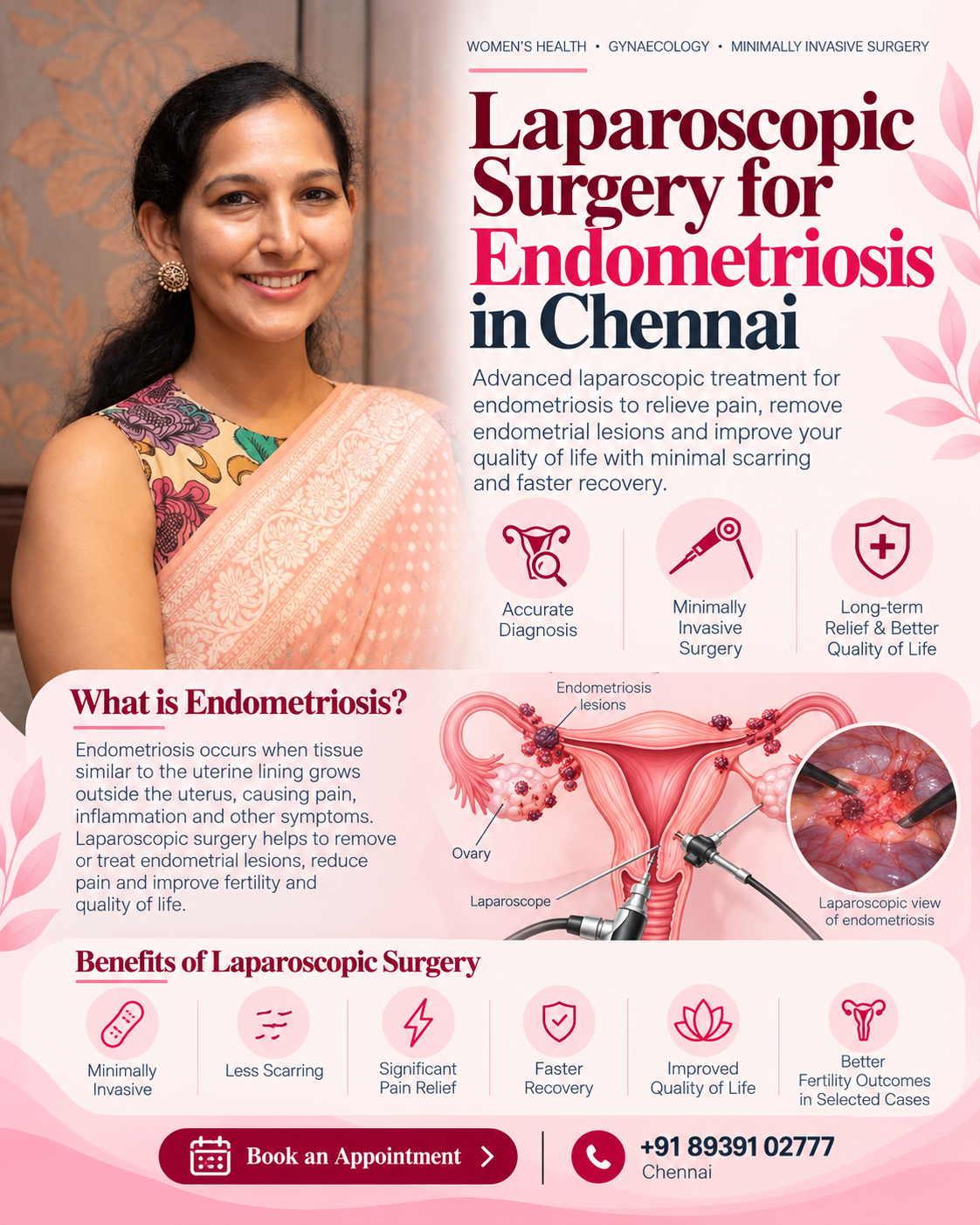 Laparoscopic Surgery for Endometriosis in Chennai with Dr. Shruthi Sreedhar