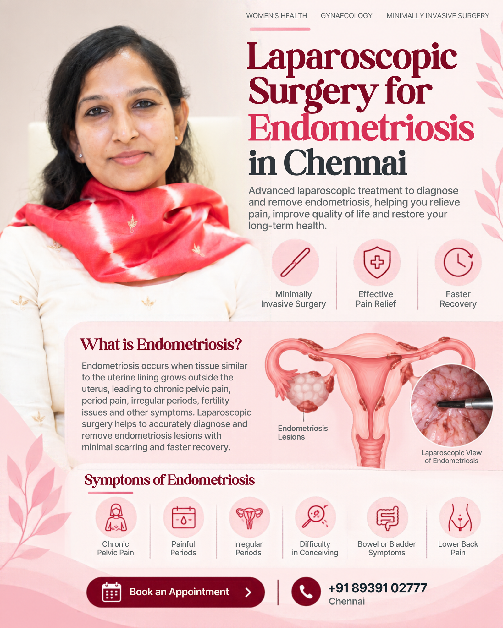 Laparoscopic Surgery for Endometriosis in Chennai